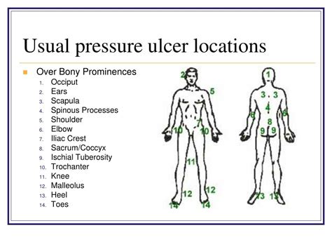 Pressure Ulcer Positioning