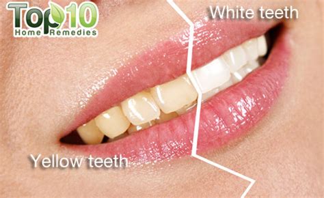 Home Remedies for Yellow Teeth | Top 10 Home Remedies