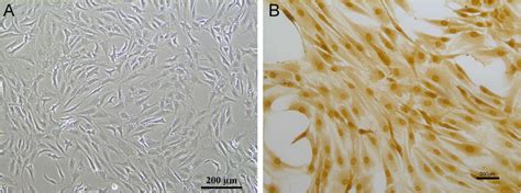 cell morphology of nucleus pulposus cells (a); immunohistochemical of ...