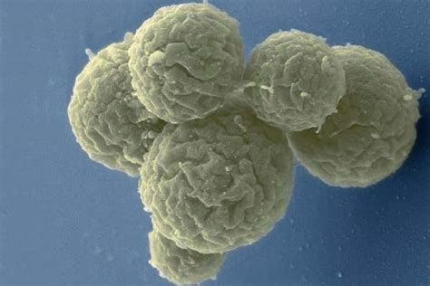 Artificial cell designed in lab reveals genes essential to life | New Scientist