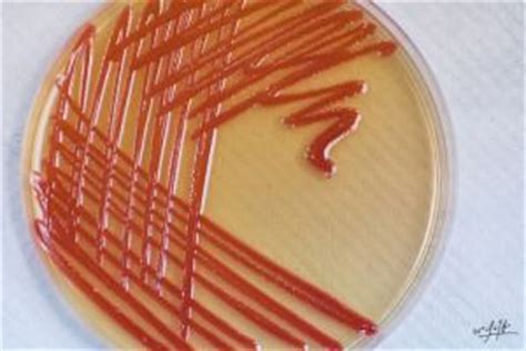 Serratia Species Pathogenesis and Infectious Disease | Medical Laboratories