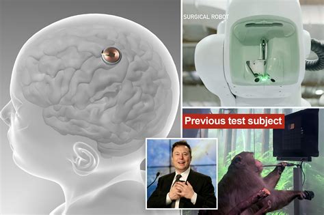 Elon Musk’s startup Neuralink implants chip into brain of first human test subject