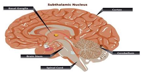 Subthalamic Nucleus - Assignment Point