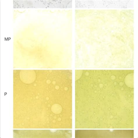 (PDF) The importance of obtaining a sputum sample and how it can aid ...