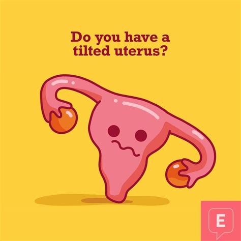 Living with A Tilted Uterus | Retroverted uterus, Uterus, Ovulation pain