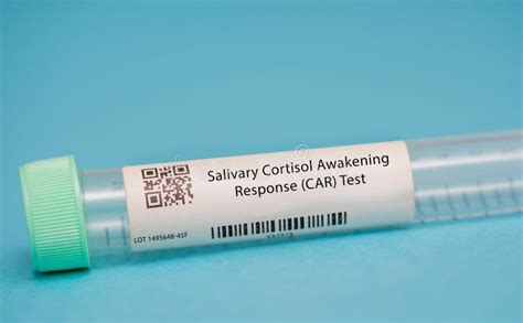 Salivary Cortisol Awakening Response (CAR) Test Stock Photo - Image of diagnosis, cortisol ...