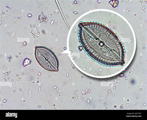 Diatom algae microscopy hi-res stock photography and images - Alamy