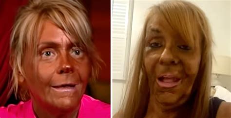 What happened to "Tan Mom" Patricia Krentcil? This is her today