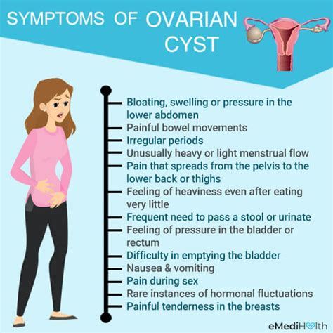 Ovari Cyst – Punca, Simptom dan Rawatan - IsteriSihat.Com.My