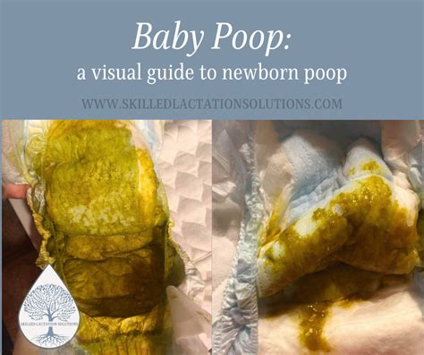 Baby Poop: A Visual Guide to Newborn Poop