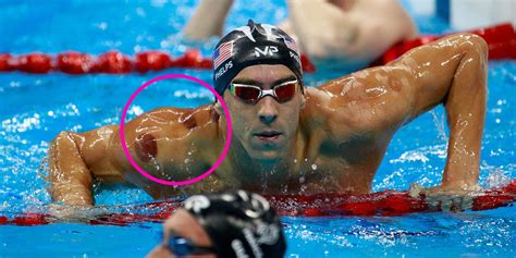 Spots on Michael Phelps - What is Cupping