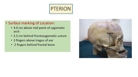 PTERION Anatomy - YouTube