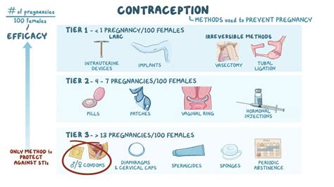 Contraception: Clinical practice - Osmosis