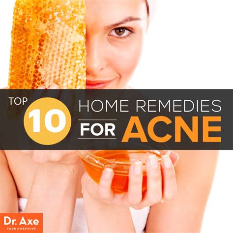 Skin Care Chronicle: Top 10 Home Remedies for Acne