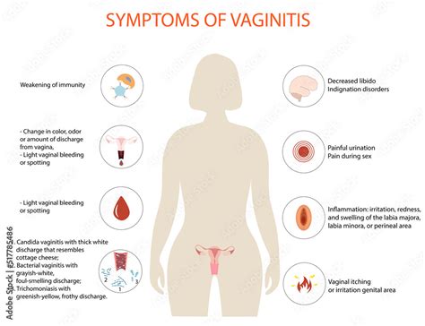 symptoms of vaginitis, vector medical illustration Stock Vector | Adobe Stock