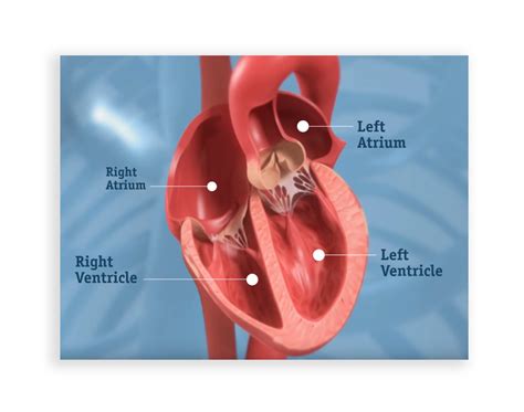 Severe Aortic Valve Stenosis - Boston Scientific