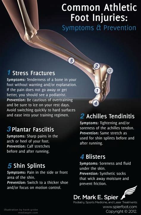 Types of Common Foot Injuries…