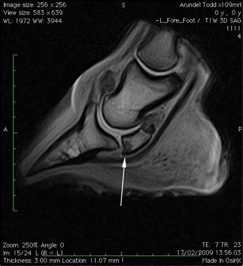 Navicular Syndrome - Your Horse