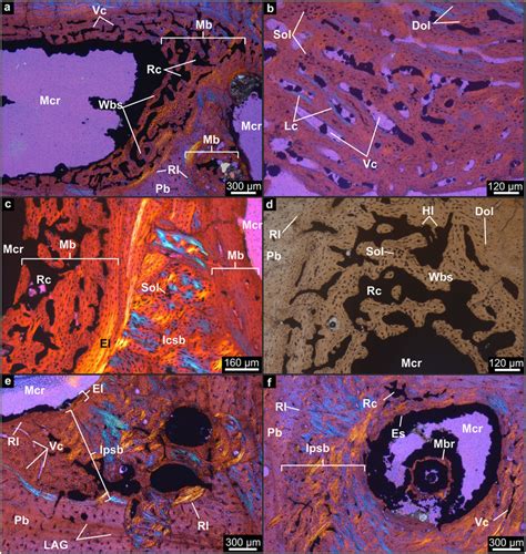 Microanatomy and histology of the medullary bone-like tissue and the... | Download Scientific ...