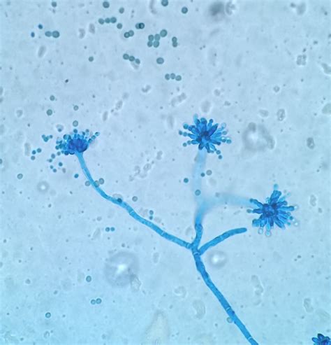 Aspergillus glaucus Marine Environment, Microbiology, Fungi, Free, Chart, Mushrooms