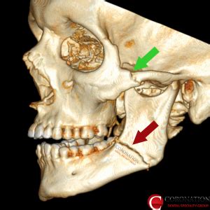 Pin on Cases and Patients