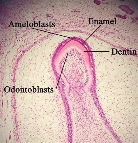 Ameloblast - Wikipedia