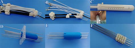 Frontiers | Analysis of Applicator Insertion Related Acute Side Effects ...