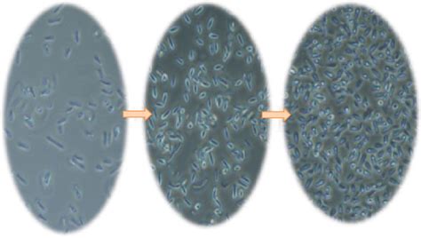 2 Different stages of bacteria during ABE fermentation. | Download ...