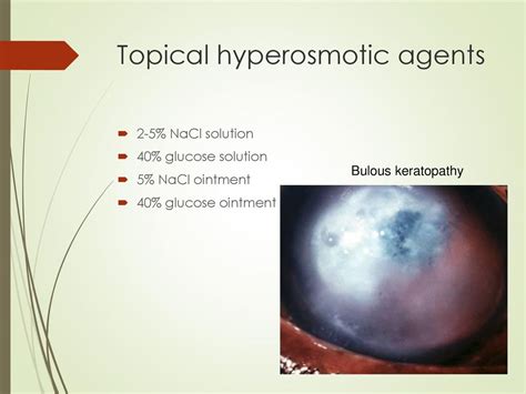 Pharmacology of the eye - ppt download