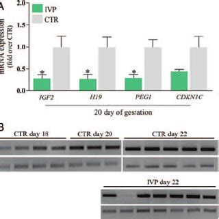 Down-regulated expression of imprinted genes and methylation defect on ...