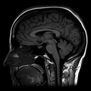 Brain Magnetic Resonance Imaging Technique: Approach Considerations, In the MRI Machine, Guidelines