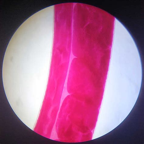 life cycle of trichuris trichiura (whipworm), egg and adult whole mount prepared slides ...