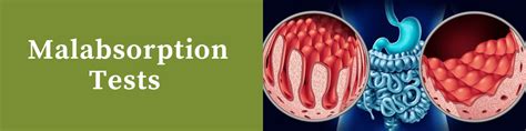 Malabsorption - Ulta Lab Tests