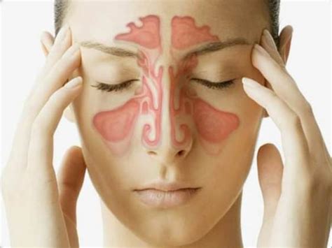 Home Remedies for Nasal Congestion Relief