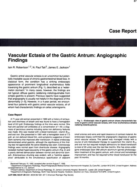 Vascular ectasia of the gastric antrum: angiographic findings. | AJR