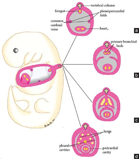 Congenital Absence of the Right Pericardium: Embryology and Imaging - Journal of Clinical ...