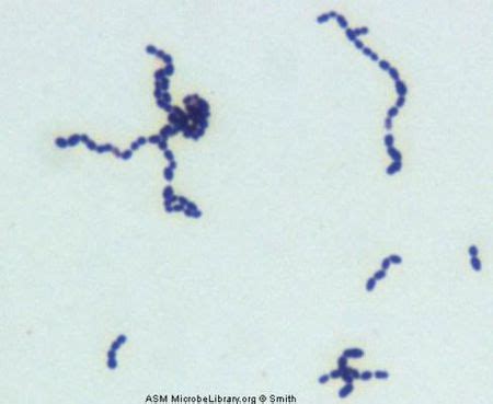 Streptococcus oralis - microbewiki