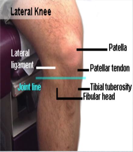 External Anterior Knee Exam