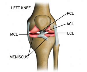 Physiotherapy Rehabilitation for Anterior Cruciate Ligament Injury