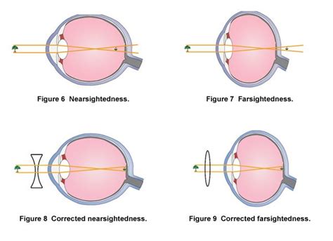 Human Eye Optics