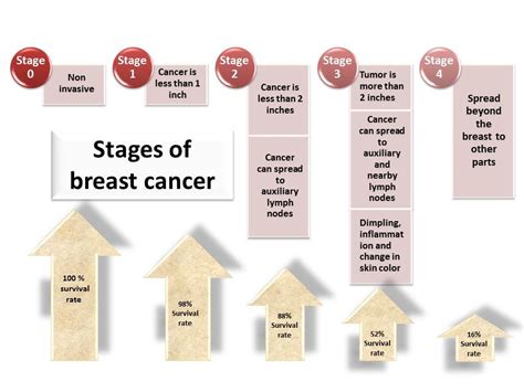 What Is Stage Breast Cancer Symptoms Breastcancertalk Net | Hot Sex Picture