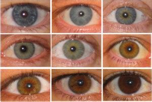 What color are your eyes exactly? | Eye Doctors of Washington