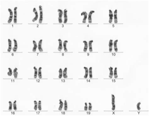 File:Karyotype of normal male mouse.png - Wikimedia Commons