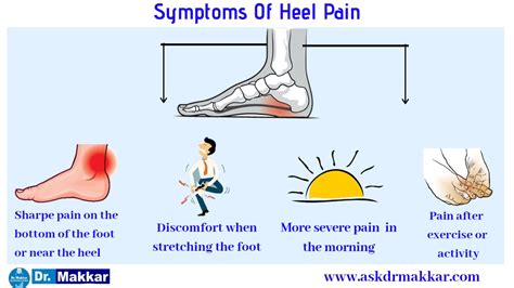 Calcaneal spur Homeopathic Treatment Heel pain Progressive damage