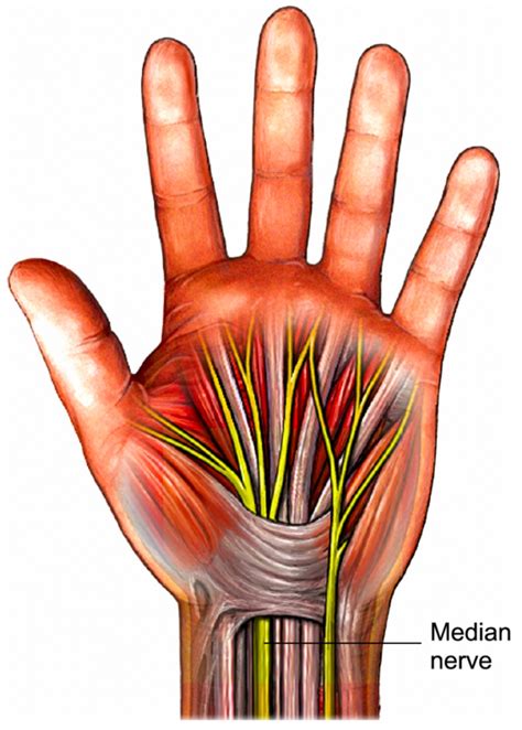 Carpal Tunnel Syndrome – Aberdeen Virtual Hand Clinic