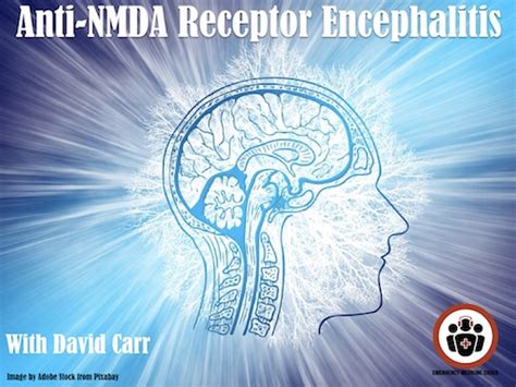 David Carr on Anti-NMDA Receptor Encephalitis