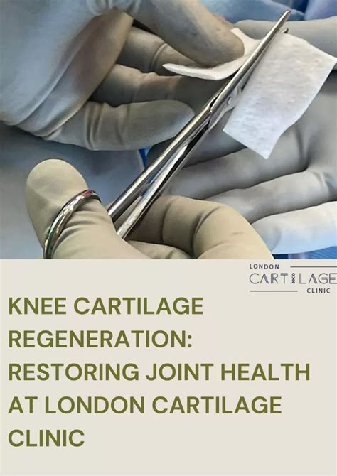 PPT - Knee Cartilage Regeneration Restoring Joint Health at London Cartilage Clinic PowerPoint ...