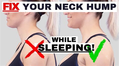 BEST sleeping position to FIX Neck Hump, Hunchback, or Forward Head Posture | Dr. Jon Saunders ...