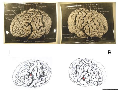 Albert Einstein's Brain: 12 Facts About Gray Matter Of Scientific ...