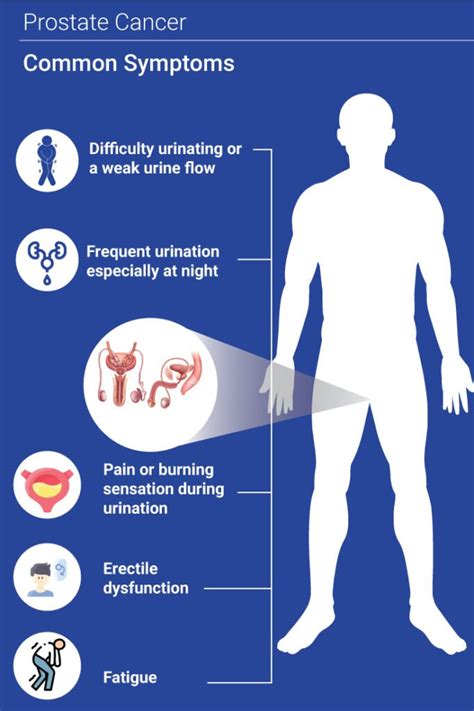 Prostate Cancer: Causes, Symptoms, and Treatment